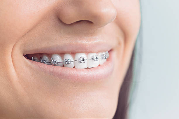 Best Full Mouth Reconstruction  in Bellows Falls, VT